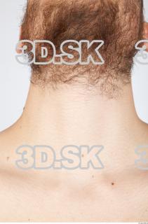 Neck texture of Charlie 0001